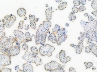 beta Catenin Recombinant Rabbit mAb - BF3048 at 1/100 staining Human placental tissue by IHC-P.