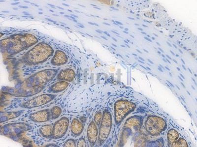 beta Catenin Recombinant Rabbit mAb - BF3048 at 1/100 staining Mouse rectal tissue by IHC-P.