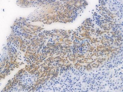 beta Catenin Recombinant Rabbit mAb - BF3048 at 1/100 staining Human tonsil tissue by IHC-P.