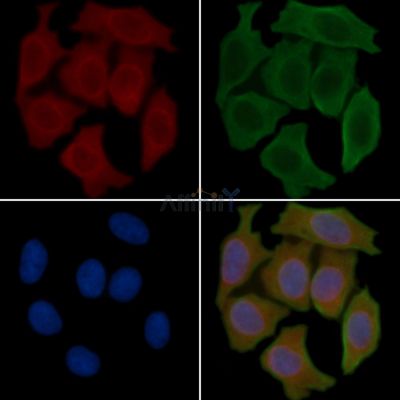 IL6 Recombinant Rabbit mAb - BF3050 staining Hela cells(30min of UV treatment) by IF/ICC.