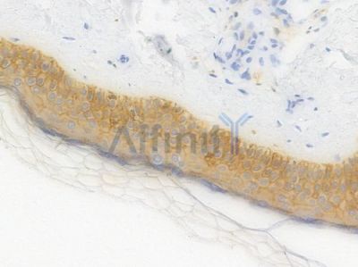 E-cadherin Recombinant Rabbit mAb - BF3053 at 1/100 staining Human skin tissue by IHC-P.