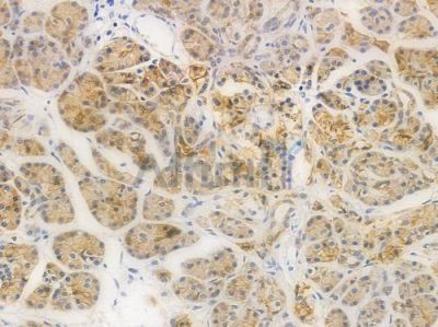 E-cadherin Recombinant Rabbit mAb - BF3053 at 1/100 staining Human pancreatic tissue by IHC-P.