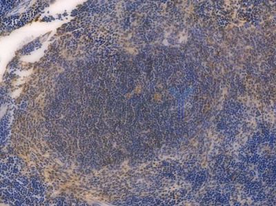 IRF3 Recombinant Rabbit mAb - BF3058 at 1/100 staining Mouse spleen tissue by IHC-P.