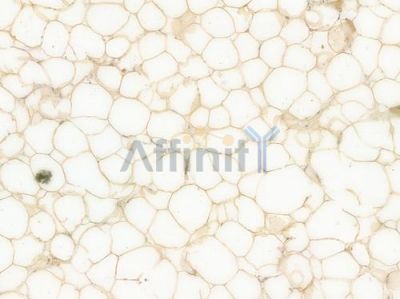 ACSL4/FACL4 Recombinant Rabbit mAb - BF3064 at 1/100 staining Human heart tissue by IHC-P.