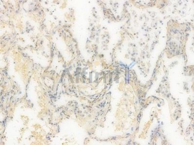 ACSL4/FACL4 Recombinant Rabbit mAb - BF3064 at 1/100 staining Human lung tissue by IHC-P.