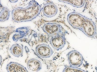 TBK1 Recombinant Rabbit mAb - BF3065 at 1/100 staining Human testicular tissue by IHC-P.