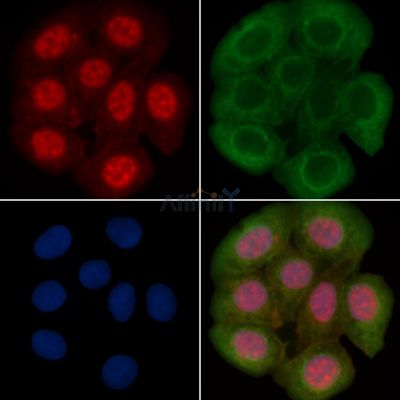 GSK3 beta Recombinant Rabbit mAb - BF3074 staining Hela cells(30min of UV treatment) by IF/ICC.