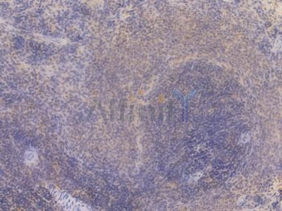 Smad3 Recombinant Rabbit mAb - BF3079 at 1/100 staining Rat spleen tissue by IHC-P.