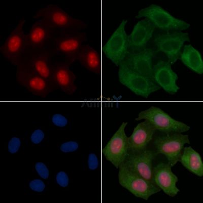 YAP Recombinant Rabbit mAb - BF3083 staining Hela cells(30min of UV treatment) by IF/ICC.