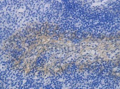 EGFR Recombinant Rabbit mAb - BF3085 at 1/100 staining Human tonsil tissue by IHC-P.