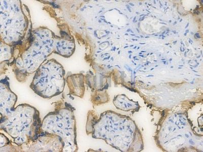 EGFR Recombinant Rabbit mAb - BF3085 at 1/100 staining Human placental tissue by IHC-P.