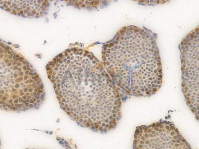 SOX9 Recombinant Rabbit mAb - BF3087 at 1/100 staining Mouse testicular tissue by IHC-P.