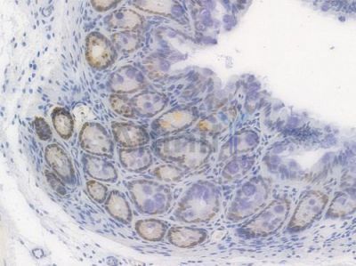 SOX9 Recombinant Rabbit mAb - BF3087 at 1/100 staining Mouse rectal tissue by IHC-P.