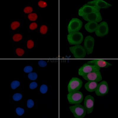 Phospho-Histone H2A.X (Ser139) Recombinant Rabbit mAb - BF3088 staining Hela cells(30min of UV treatment) by IF/ICC.