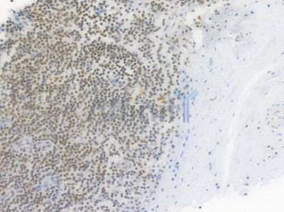 Phospho-Histone H2A.X (Ser139) Recombinant Rabbit mAb - BF3088 at 1/100 staining Human tonsil tissue by IHC-P.