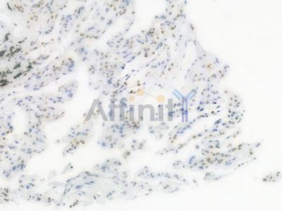 Phospho-Histone H2A.X (Ser139) Recombinant Rabbit mAb - BF3088 at 1/100 staining Human lung tissue by IHC-P.