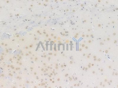 Phospho-Histone H2A.X (Ser139) Recombinant Rabbit mAb - BF3088 at 1/100 staining Rat brain tissue by IHC-P.