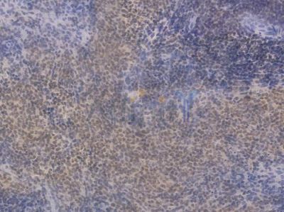 Phospho-Histone H2A.X (Ser139) Recombinant Rabbit mAb - BF3088 at 1/100 staining Rat spleen tissue by IHC-P.