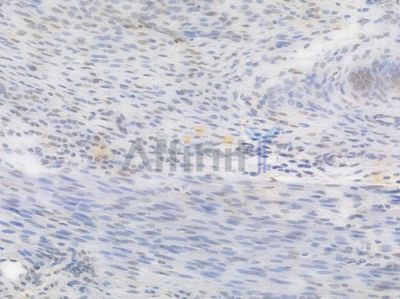 Phospho-Histone H2A.X (Ser139) Recombinant Rabbit mAb - BF3088 at 1/100 staining Rat uterine tissue by IHC-P.