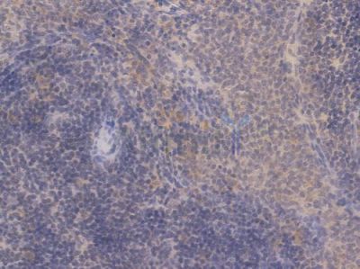 Estrogen Receptor-alpha Recombinant Rabbit mAb - BF3094 at 1/100 staining Rat spleen tissue by IHC-P.