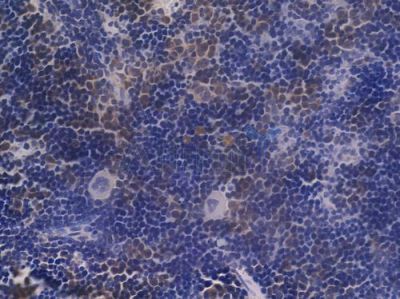 Estrogen Receptor-alpha Recombinant Rabbit mAb - BF3094 at 1/100 staining Mouse spleen tissue by IHC-P.