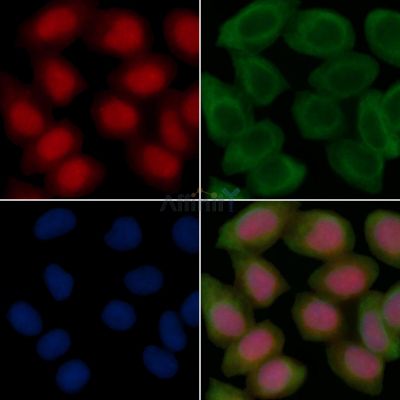 4E-BP1 Recombinant Rabbit mAb - BF3107 staining Hela cells(30min of UV treatment) by IF/ICC.