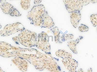 4E-BP1 Recombinant Rabbit mAb - BF3107 at 1/100 staining Human placental tissue by IHC-P.