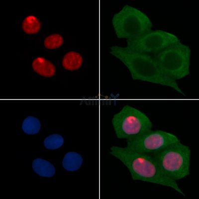 Phospho-CREB (Ser133) Recombinant Rabbit mAb - BF3117 staining Hela cells(30min of UV treatment) by IF/ICC.