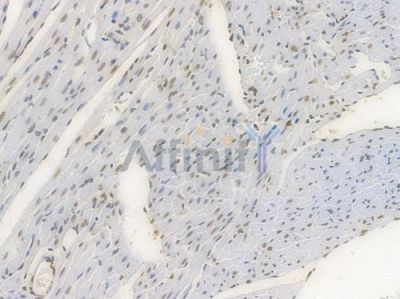 Phospho-CREB (Ser133) Recombinant Rabbit mAb - BF3117 at 1/100 staining Mouse heart tissue by IHC-P.