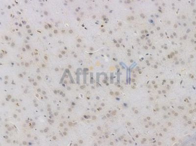 Phospho-CREB (Ser133) Recombinant Rabbit mAb - BF3117 at 1/100 staining Mouse brain tissue by IHC-P.