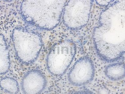 Phospho-CREB (Ser133) Recombinant Rabbit mAb - BF3117 at 1/100 staining Human gastric tissue by IHC-P.