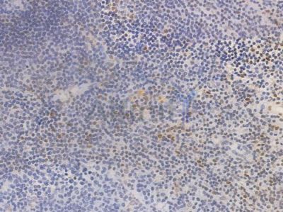 Phospho-CREB (Ser133) Recombinant Rabbit mAb - BF3117 at 1/100 staining Human tonsil tissue by IHC-P.