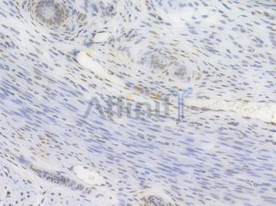 Phospho-CREB (Ser133) Recombinant Rabbit mAb - BF3117 at 1/100 staining Rat uterine tissue by IHC-P.