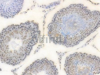 Phospho-CREB (Ser133) Recombinant Rabbit mAb - BF3117 at 1/100 staining Rat testicular tissue by IHC-P.