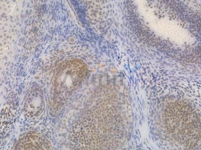 Phospho-CREB (Ser133) Recombinant Rabbit mAb - BF3117 at 1/100 staining Rat ovarian tissue by IHC-P.