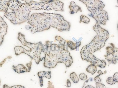 CREB Recombinant Rabbit mAb - BF3118 at 1/100 staining Human placental tissue by IHC-P.