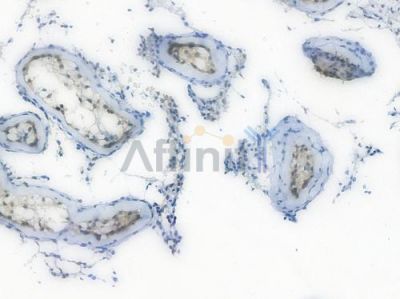 CDKN2A/p16INK4a Recombinant Rabbit mAb - BF3122 at 1/100 staining Human testicular tissue by IHC-P.