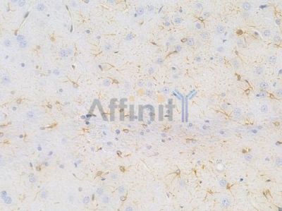 GFAP Recombinant Rabbit mAb - BF3124 at 1/100 staining Rat brain tissue by IHC-P.