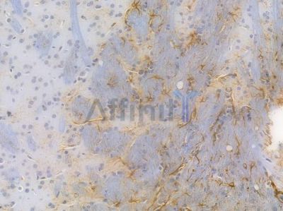 GFAP Recombinant Rabbit mAb - BF3124 at 1/100 staining Mouse brain tissue by IHC-P.