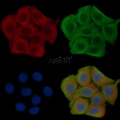 CD8 Recombinant Rabbit mAb - BF3128 staining Hela cells(30min of UV treatment) by IF/ICC.