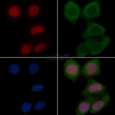 Histone H2A.X Recombinant Rabbit mAb - BF3131 staining Hela cells(30min of UV treatment) by IF/ICC.