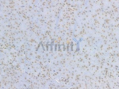 Histone H2A.X Recombinant Rabbit mAb - BF3131 at 1/100 staining Mouse brain tissue by IHC-P.