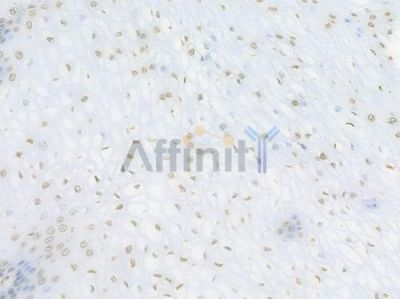 Histone H2A.X Recombinant Rabbit mAb - BF3131 at 1/100 staining Human esophageal tissue by IHC-P.
