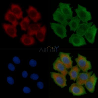 BMP2 Recombinant Rabbit mAb - BF3136 staining Hela cells(30min of UV treatment) by IF/ICC.