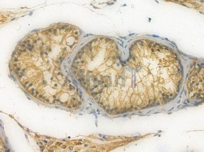 PKA alpha/beta/gamma CAT Recombinant Rabbit mAb - BF3143 at 1/100 staining Human testicular tissue by IHC-P.