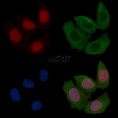 ATF4 Recombinant Rabbit mAb - BF3148 staining Hela cells(30min of UV treatment) by IF/ICC.