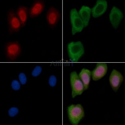 NeuN Recombinant Rabbit mAb - BF3150 staining Hela cells(30min of UV treatment) by IF/ICC.