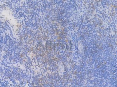 Phospho-c-Jun (Ser63) Recombinant Rabbit mAb - BF3151 at 1/100 staining Human tonsil tissue by IHC-P.