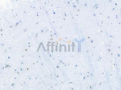 c-Jun Recombinant Rabbit mAb - BF3152 at 1/100 staining Human tonsil tissue by IHC-P.