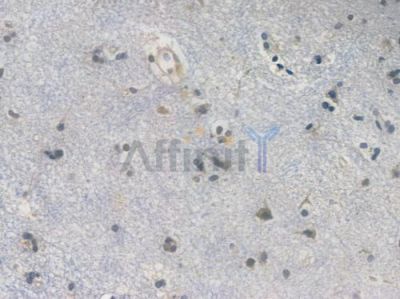 TSG101 Recombinant Rabbit mAb - BF3153 at 1/100 staining Human brain tissue by IHC-P.